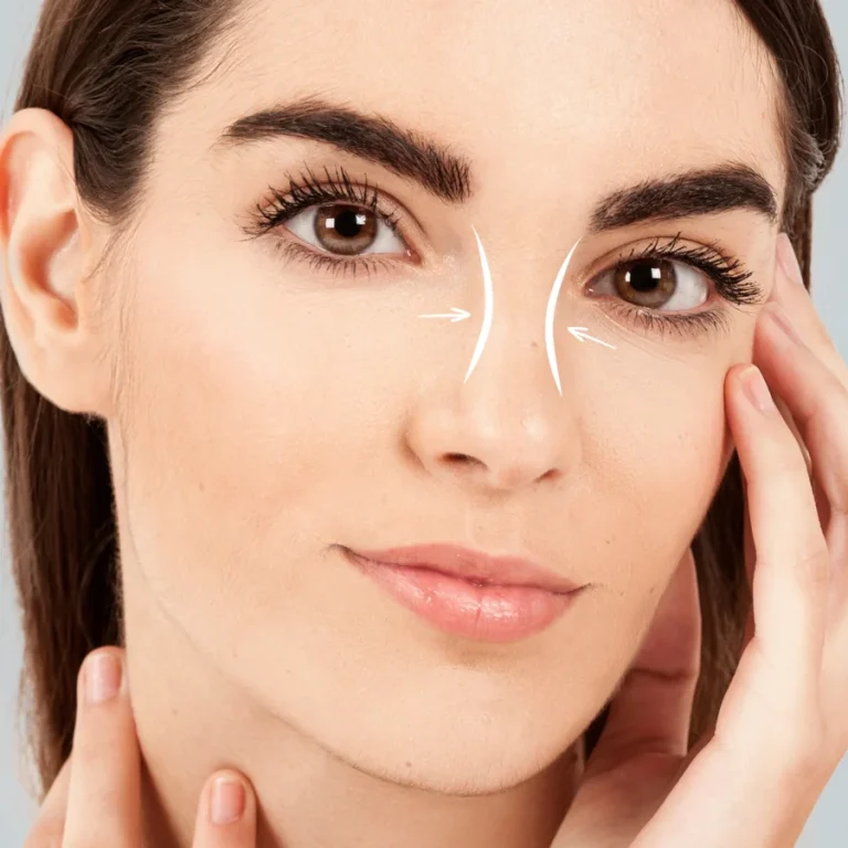 home-1-8-rhinoplasty.webp